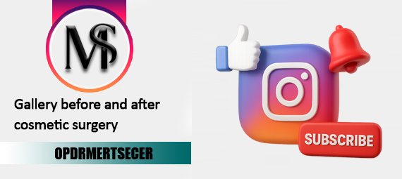 slider-banner