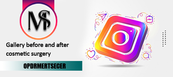 slider-banner